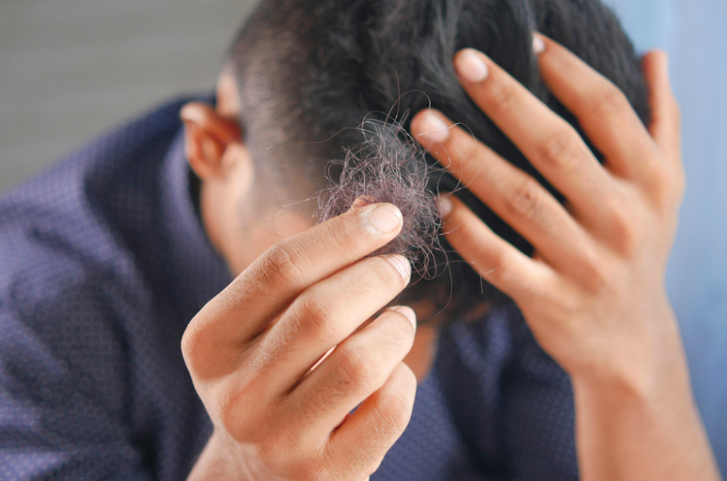 Can Diabetes Cause Hair Loss?